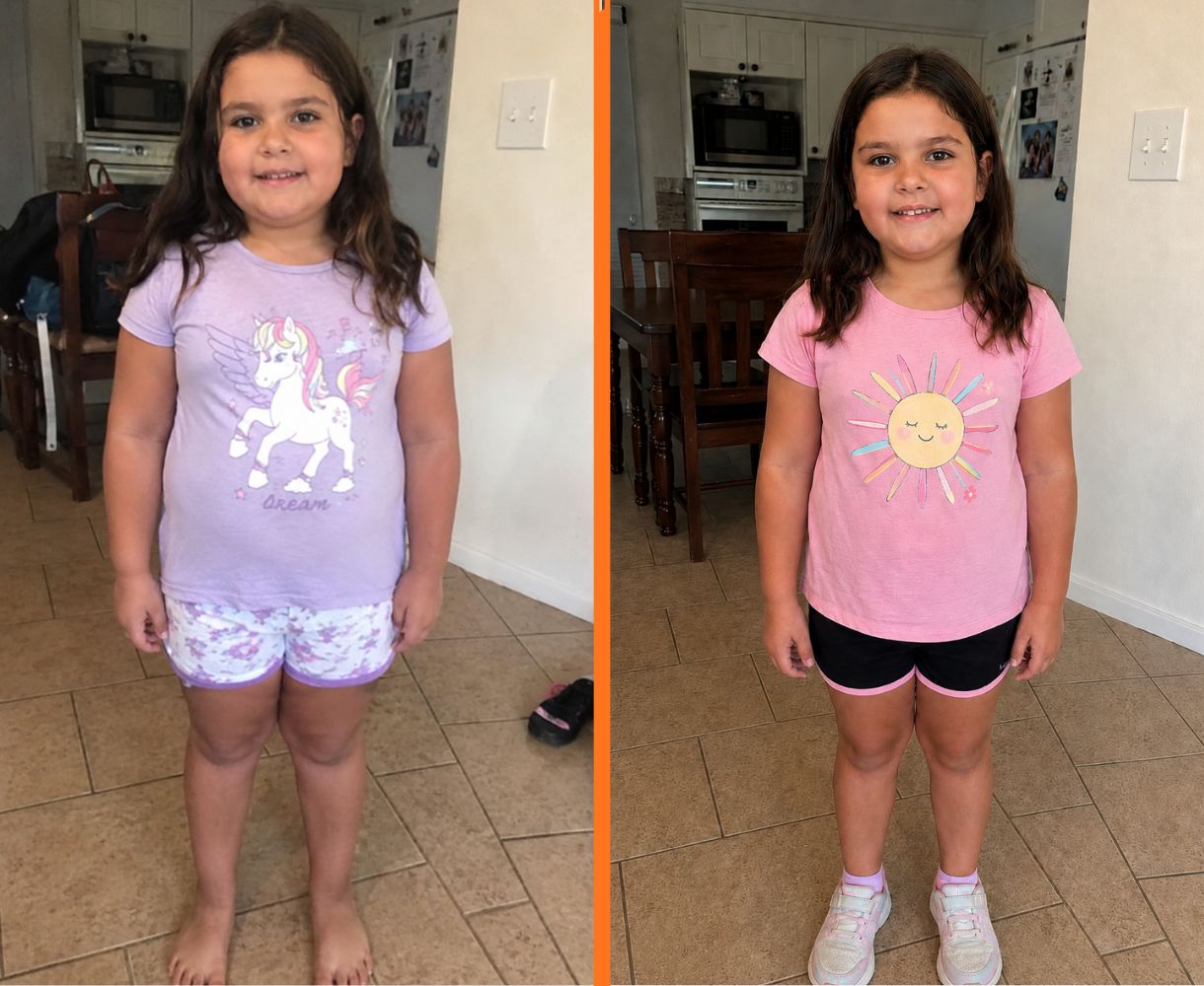 Sofia, age 7 — before and after