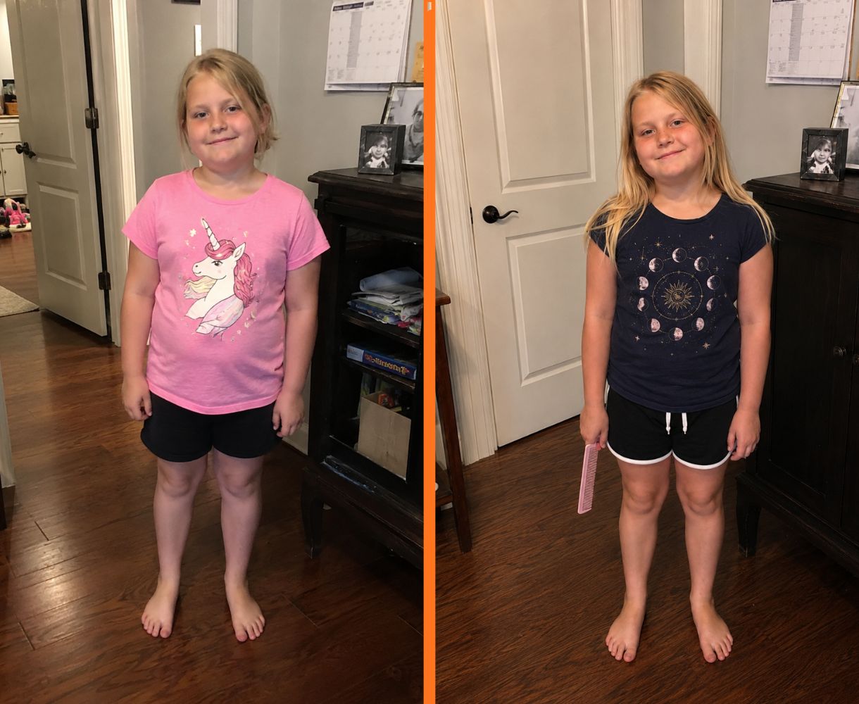 Mia, age 9 — before and after